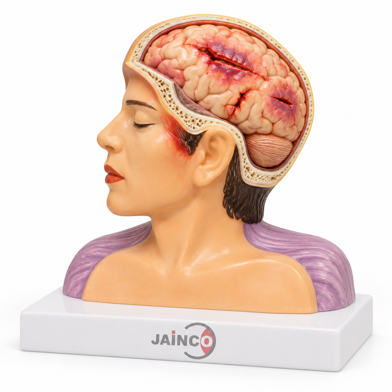 Laceration of Brain Model